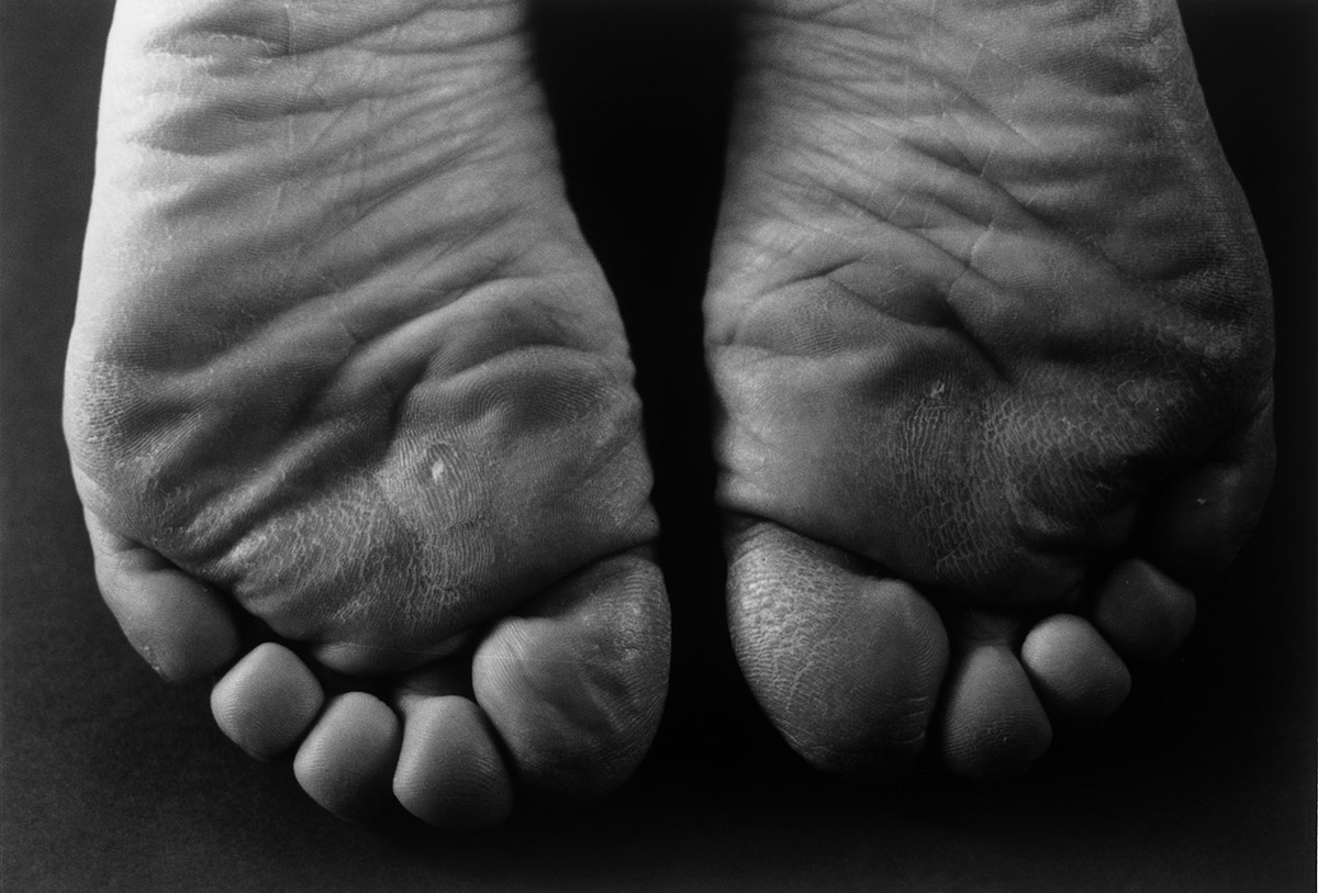 7. 1·9·4·7 #15_Ishiuchi Miyako_gelatin silver print_1988-1989