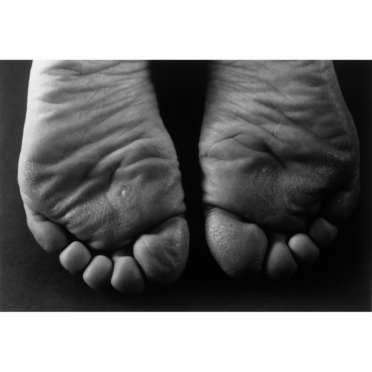 7. 1·9·4·7 #15_Ishiuchi Miyako_gelatin silver print_1988-1989_結果