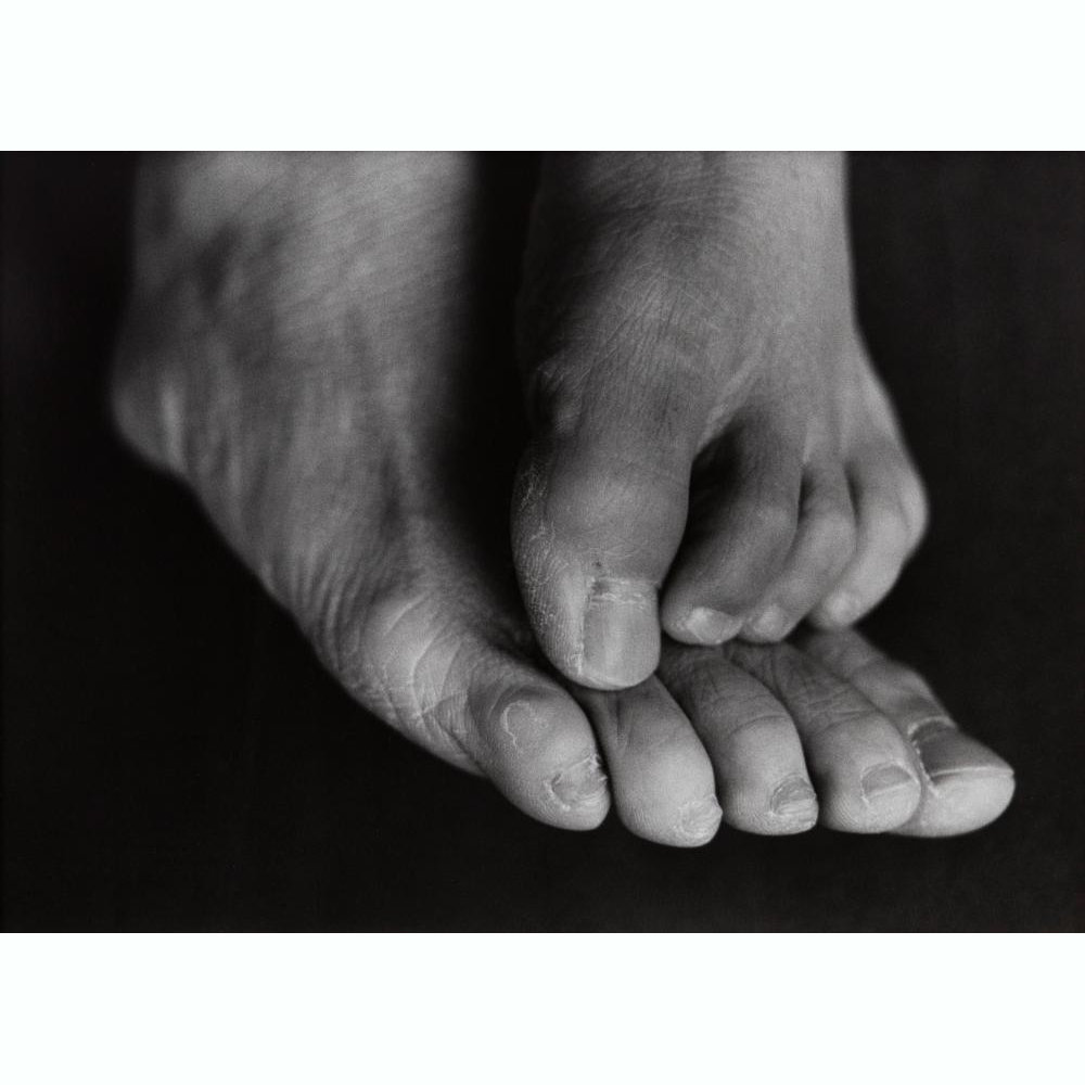 9. 1·9·4·7 #10_Ishiuchi Miyako_gelatin silver print_1996_結果